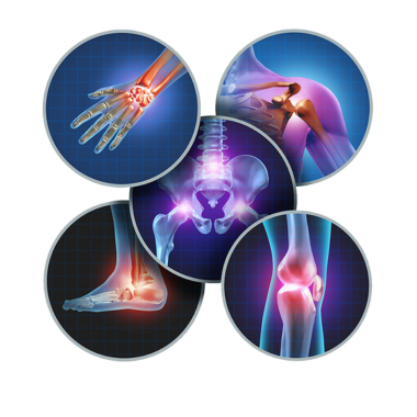 गठिया / जोड़ों का दर्द