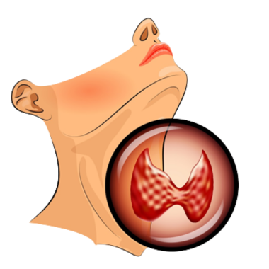 थायराइड